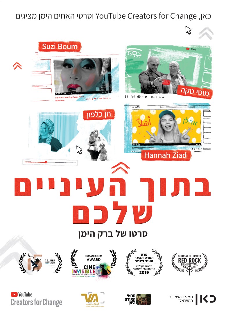 15.6 בתוך העיניים שלכם